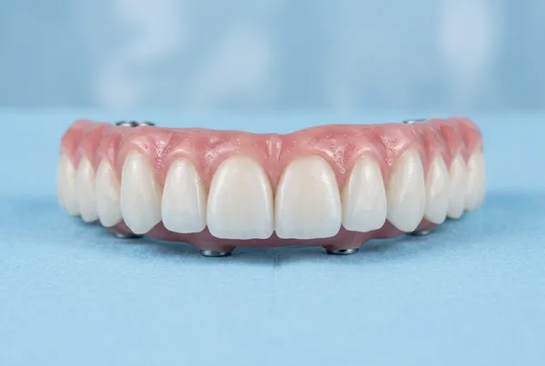 Serviço odontológico: Prótese Protocolo Fixo - Dr. Luciano Freire em Passos MG